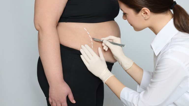 Cirurgia Bariátrica Negada Pelo Plano? Isso é Abusivo e a Justiça Está do Seu Lado